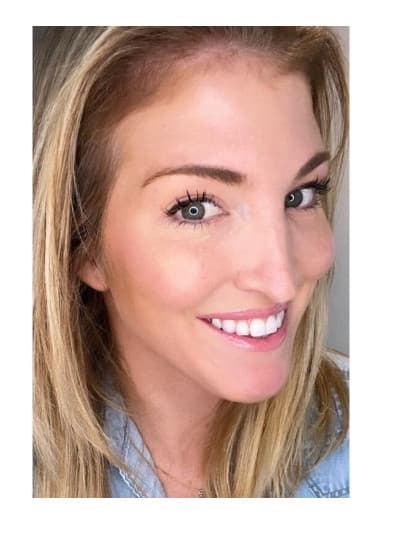 After botox/xeomin, front view — a patient of Dr. George Ferzli, New York