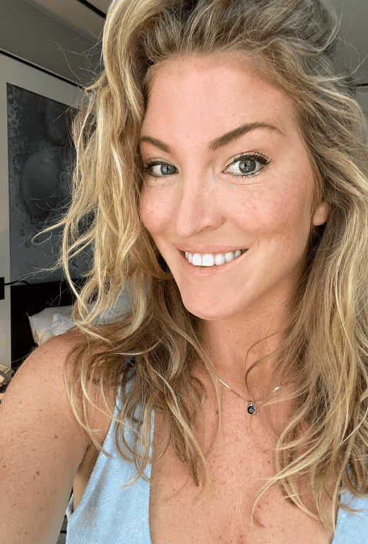 After botox / xeomin, front view — a patient of Dr. George Ferzli, New York